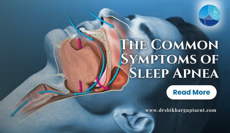The Common Symptoms of Sleep Apnea
