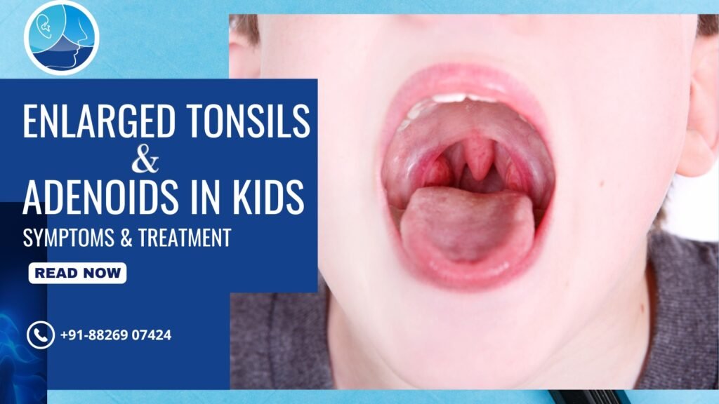 Enlarged Tonsils & Adenoids in Kids: Symptoms & Best Tonsillitis Treatment in Rohini