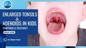 Enlarged Tonsils & Adenoids in Kids: Symptoms & Best Tonsillitis Treatment in Rohini