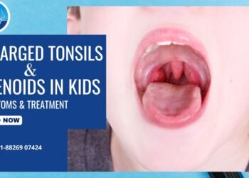 Enlarged Tonsils & Adenoids in Kids: Symptoms & Best Tonsillitis Treatment in Rohini