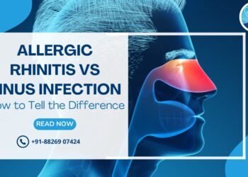 Allergic Rhinitis vs Sinus Infection: How to Tell the Difference Best Allergy ENT doctor in Rohini