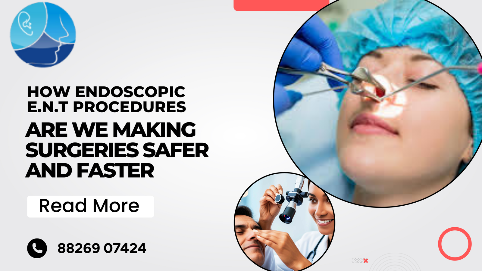 How Endoscopic E.N.T Procedures Are Making Surgeries Safer and Faster Best ENT Doctor in Rohini