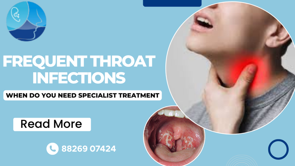 Frequent Throat Infections: When Do You Need Specialist Treatment?