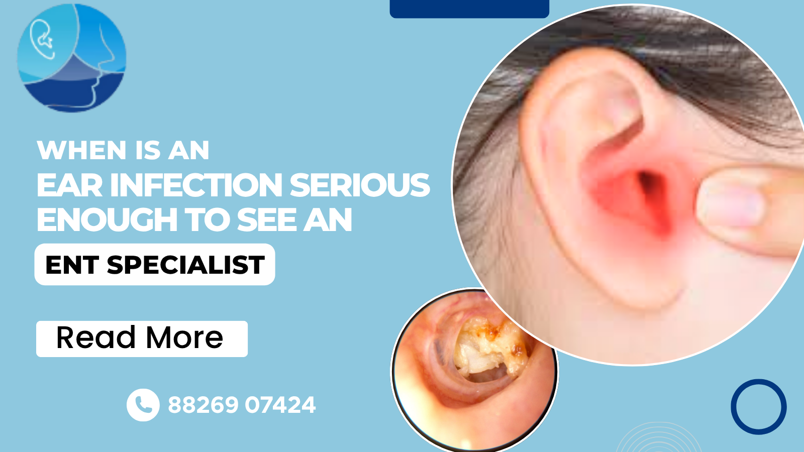 When Is an Ear Infection Serious Enough To See An ENT Specialist?