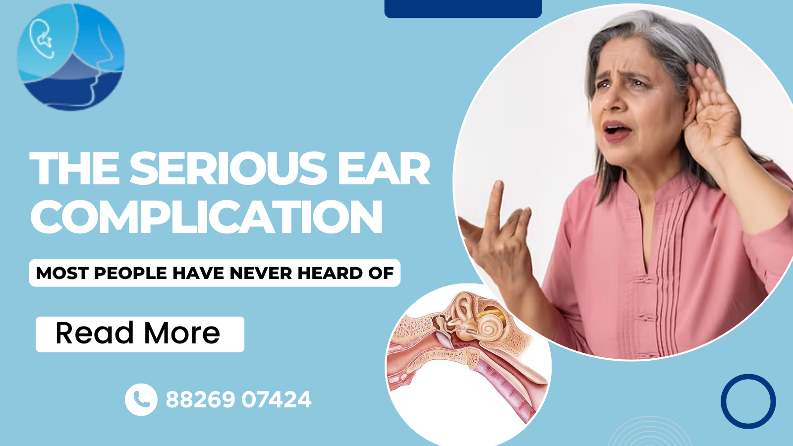 The Serious Ear Complication Most People Have Never Heard Of, best ENT doctor in Rohini.