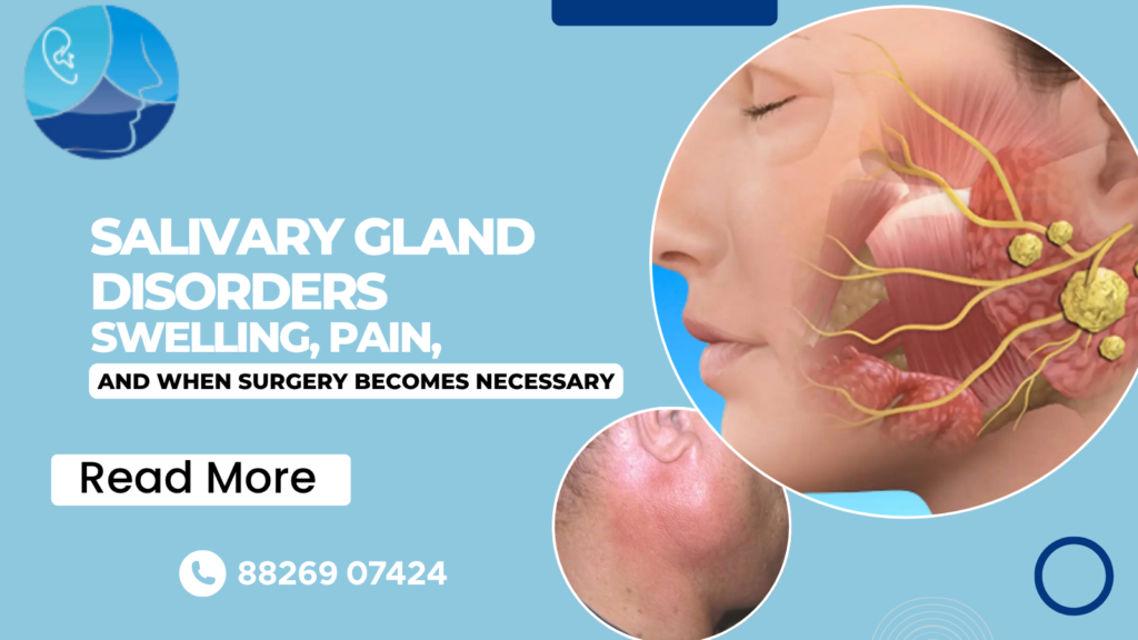 Salivary Gland Disorders: Swelling, Pain, and When Surgery Becomes Necessary